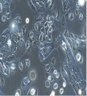 人肺腺癌细胞NCI-H441（STR鉴定）