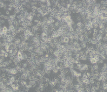 HMEC-1（人微血管内皮细胞）通过STR鉴定