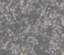 HMy2.CIR（人B淋巴母细胞）通过STR鉴定