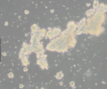 AtT-20（小鼠垂体瘤细胞）