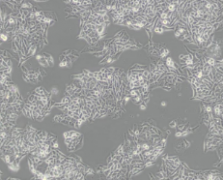 BEL-7404（人肝癌细胞）