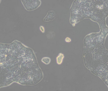 Calu-3（人肺腺癌细胞（胸水））(通过STR鉴定)