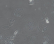 HCC827（人非小细胞肺癌细胞）(通过STR鉴定)