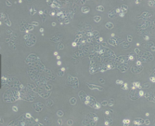 HEC-1-B（人子宫内膜腺癌细胞）通过STR鉴定