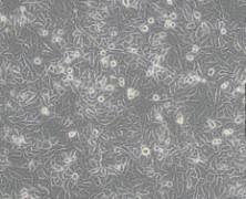 Hela（人宫颈癌细胞）(通过STR鉴定)