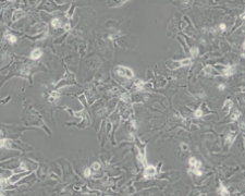 Hep 3B2.1-7（人肝癌细胞）(通过STR鉴定)