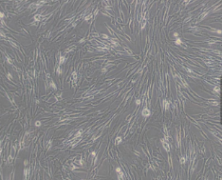 HFL1（人胚肺成纤维细胞）(通过STR鉴定)