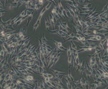 HGC-27（人胃癌细胞（未分化））(通过STR鉴定)