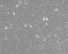 HT-1080 [HT1080]（人纤维肉瘤细胞）(通过ST