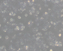 HuH-6（人肝母细胞瘤细胞）(通过STR鉴定)