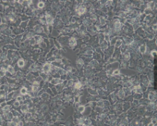 HuH-7（人肝癌细胞）(通过STR鉴定)