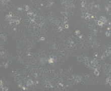 JAR（人胎盘绒毛癌细胞）(通过STR鉴定)