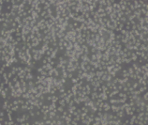 JeKo-1（人套细胞淋巴瘤细胞）(通过STR鉴定)