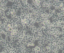 KB 人口腔表皮样癌细胞 通过STR鉴定