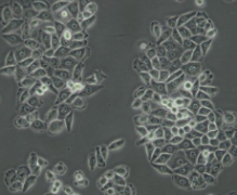 BGC-823 人胃腺癌细胞(低分化)(通过STR鉴定）
