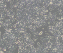 LoVo（人结肠癌细胞）通过STR鉴定