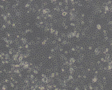 ME-180（人子宫颈表皮癌细胞）通过STR鉴定