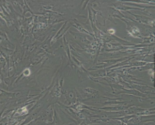 NCI-H205（人肾上腺腺瘤细胞）