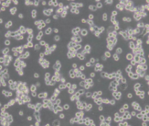 SUP-B15（人Ph+急淋白血病细胞系）