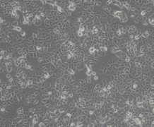 T-47D（人乳腺管癌细胞）