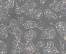 T84（人结肠腺癌肺转移细胞）