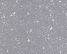 U-2 OS（人骨肉瘤细胞）