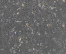 U-87 MG（人脑星形胶质母细胞瘤细胞）