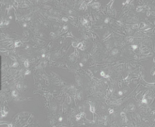 A875（人黑色素瘤细胞）