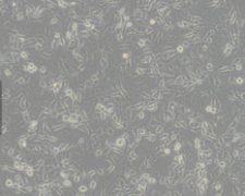 C918（人眼脉络黑色素瘤细胞）