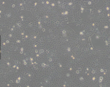 CAL 27（人舌鳞癌细胞）