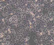 MDA-MB-468（人乳腺癌细胞）