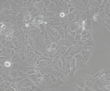 OVCAR8 人卵巢癌细胞