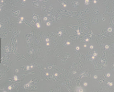LX-2（人肝星形细胞）