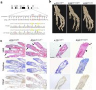 类风湿关节炎新治疗策略——预防细胞死亡