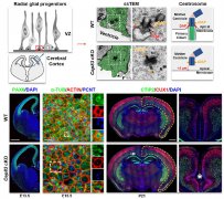 Nature：中心体调控大脑皮层发育的崭新机制